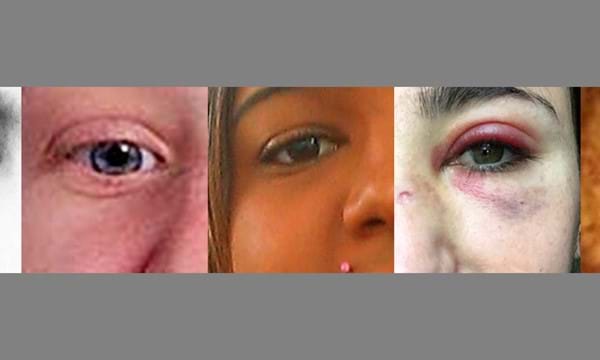Eyes of people who have all been affected by hate crime