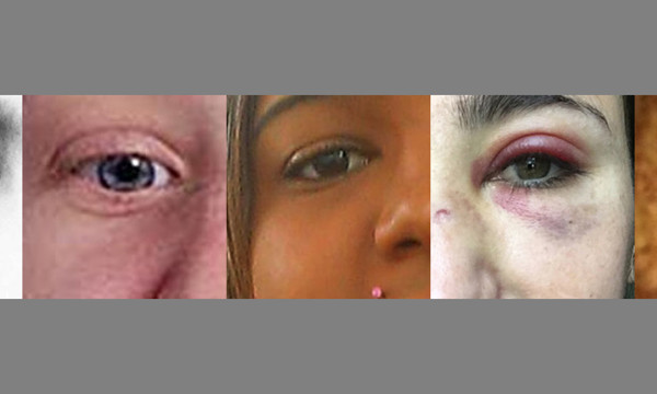 Eyes of people who have all been affected by hate crime